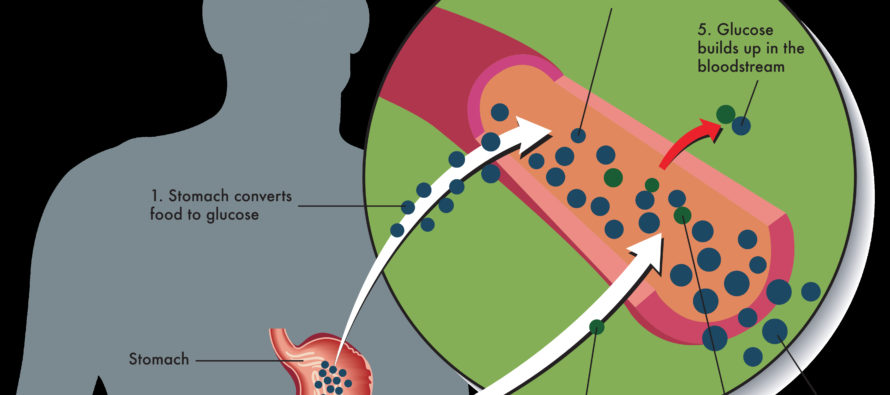 Call for healthier diets to combat alarming surge in diabetes